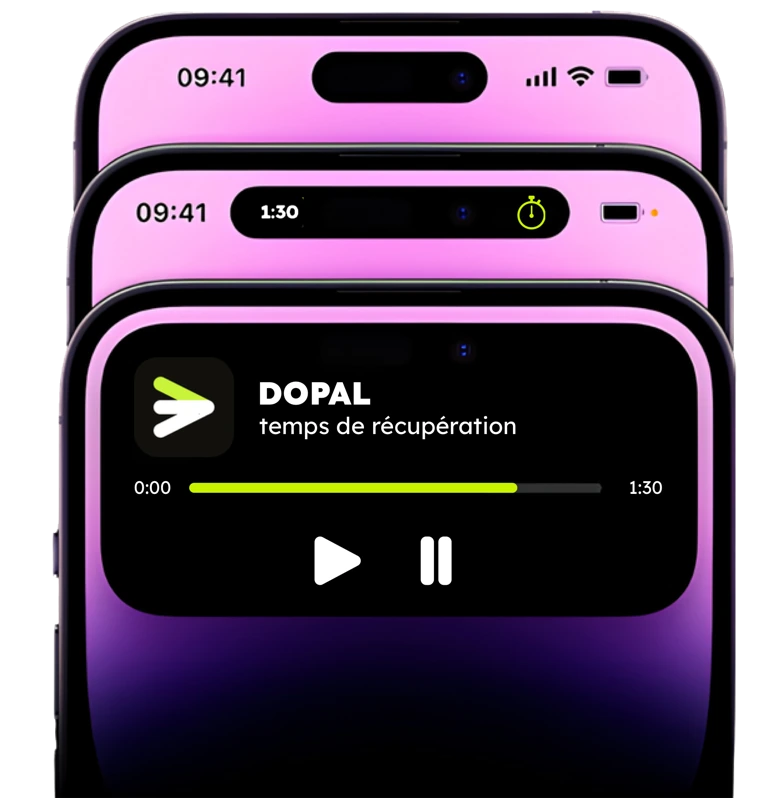 Le timer de recuperation DOPAL affiche dans la Dynamic Island d'un iPhone